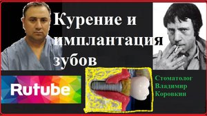 Имплант #2.Курение и имплантация. зубов.