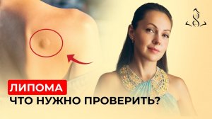 Жировик нужно удалять? Почему появляется и чем опасна липома?