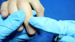 Как избавиться от заусенцев в домашних условиях