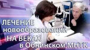 Лечение новообразований на веках в отделении МНТК "Микрохирургия глаза" г. Обнинск