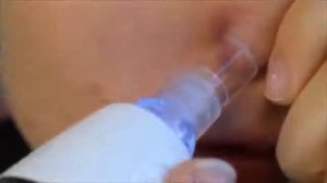ПОТРЯСАЮЩИЙ удобный вакуумный очиститель лица Spot Cleaner