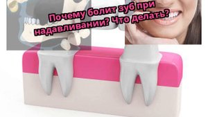 Почему болит зуб при надавливании? Что делать?