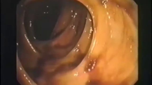 Доктор Хироми Шинья. Воздействие молочнокислых бактерий на человека. смотреть онлайн