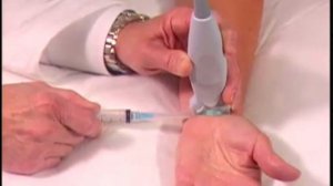 Порядок выполнения: инъекция в запястье под контролем ультразвуковой визуализации