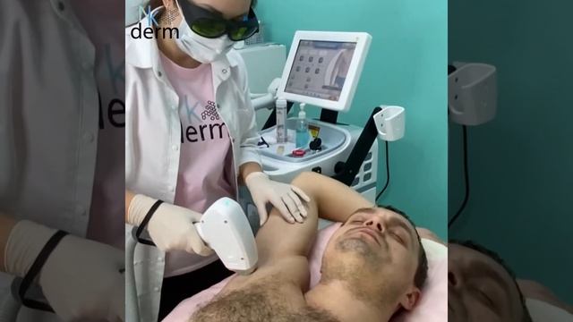 Лазерная эпиляция , акционное предложение -25%