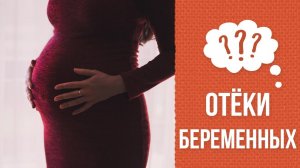 Почему беременные отекают?