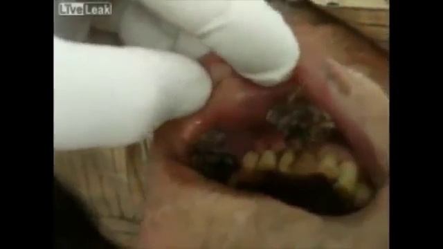 Ужас что будет, если не чистить зубы смотреть онлайн