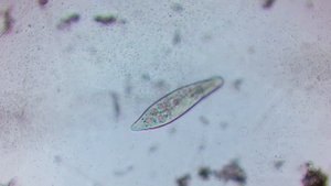 Что можно УВИДЕТЬ В КАПЛЕ ВОДЫ ИЗ ОЗЕРА под микроскопом ?