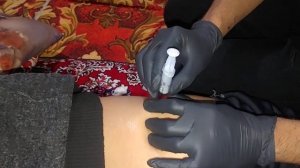 внутримышечный укол в ягодицу