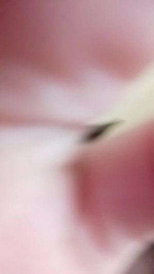 вливание скинов стендофе