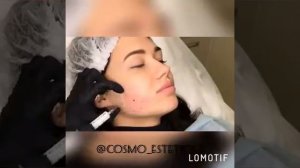 Липолитик для лица