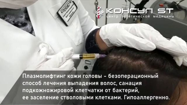 Плазмолифтинг в трихологии. Как проходит?