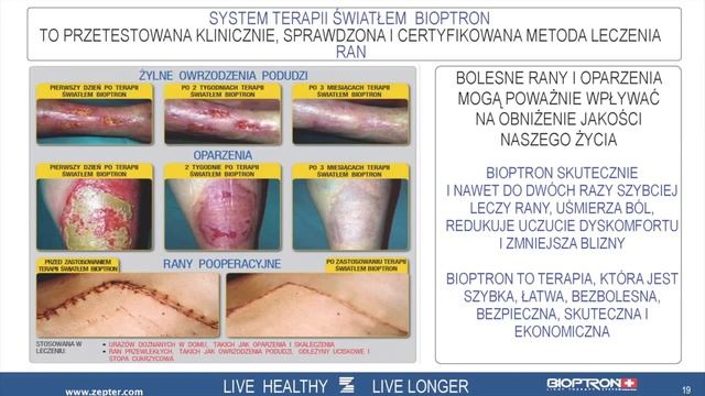 Lampy Bioptron - światło spolaryzowani i jego zastosowanie. Sklep dystrybutora medlight.pl смотреть онлайн