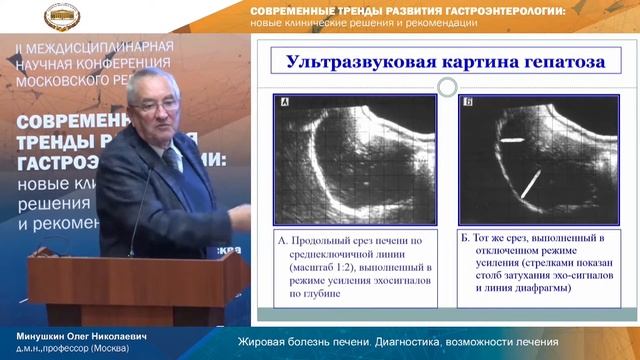 Жировая болезнь печени. Диагностика, возможности лечения. Минушкин Олег Николаевич