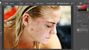 How to Remove Pimples | Photoshop