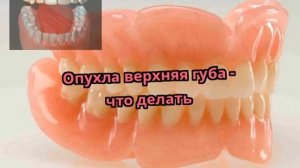 Опухла верхняя губа - что делать