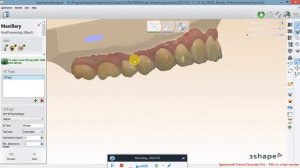 How to Export Ortho Study Models with ID Tags in 3Shape