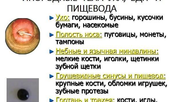 Неотложная помощь в оториноларингологии.