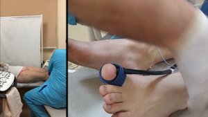 Измерение пальце-плечевого индекса методом фотоплетизмографии (профессор Куликов В.П.)