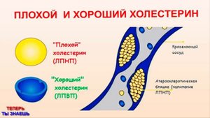 СЕМЕЧКИ Подсолнечника – ПЕРВЫЙ Союзник Для СНИЖЕНИЯ Уровня «ПЛОХОГО» ХОЛЕСТЕРИНА !!!