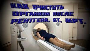Как очистить организм после МРТ КТ рентгеновского излучения