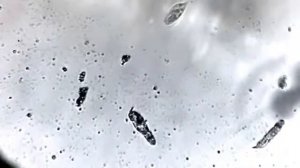 Копия видео микробы под микроскопом