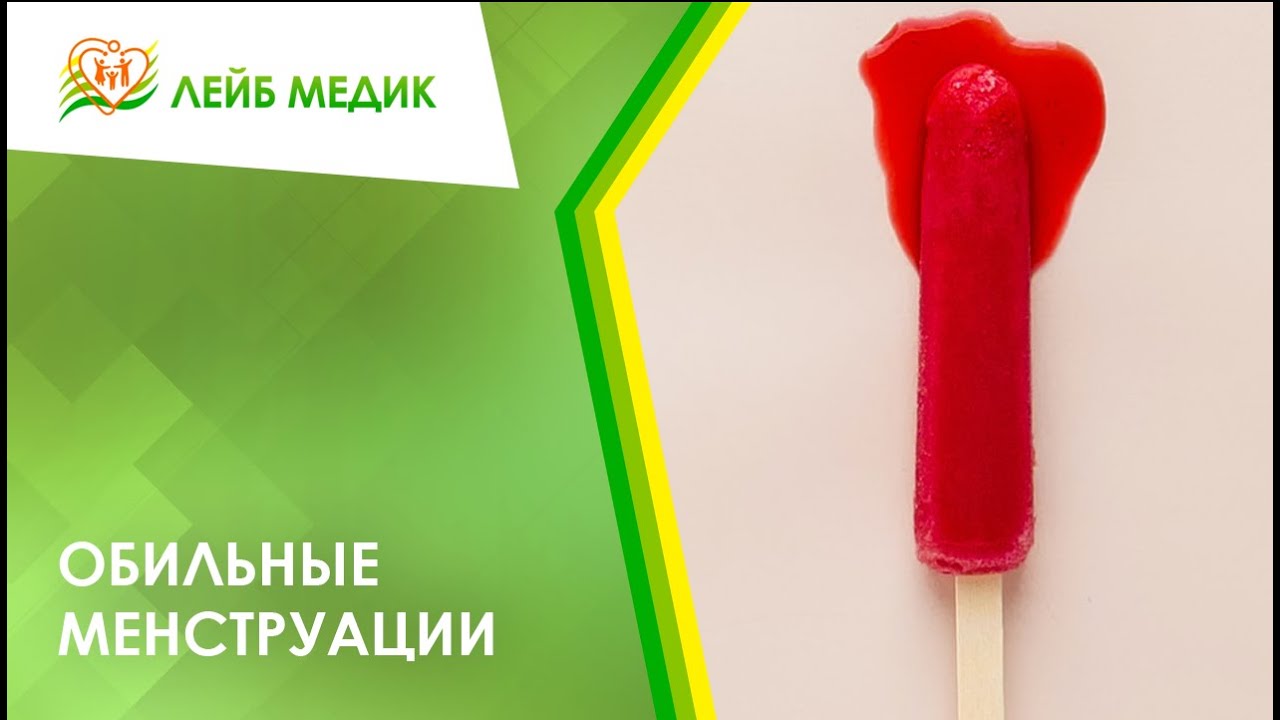 ? Обильные менструации