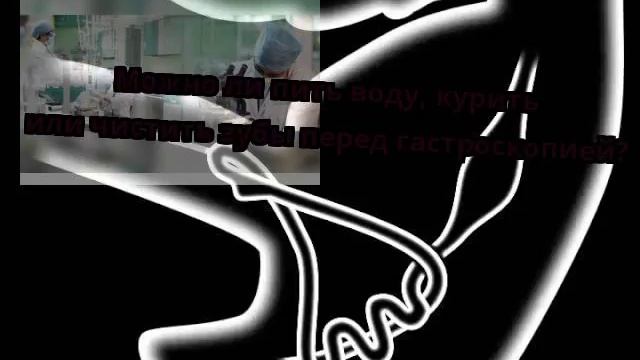 Можно ли пить воду, курить или чистить зубы перед гастроскопией? смотреть онлайн