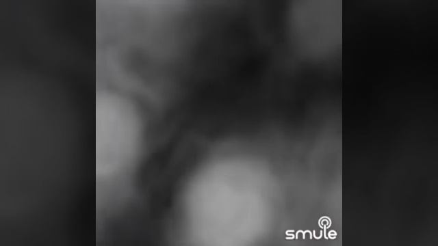 Artik&Asti Последний поцелуй смотреть онлайн