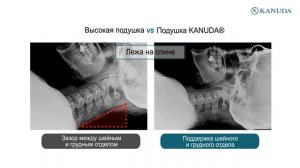 Ортопедические подушки KANUDA® vs обычные подушки