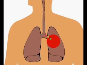 Инфекционные заболевания