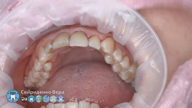 Professional oral hygiene case 006 DTE D7 Acteon Air-N-Go FloWeis Cleanic Enhance (FHD multistream)