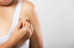 Липосакция подмышечных зон.