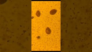 Микробы и йод под микроскопом