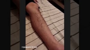 Комплекс упражнений при переломе позвоночника.