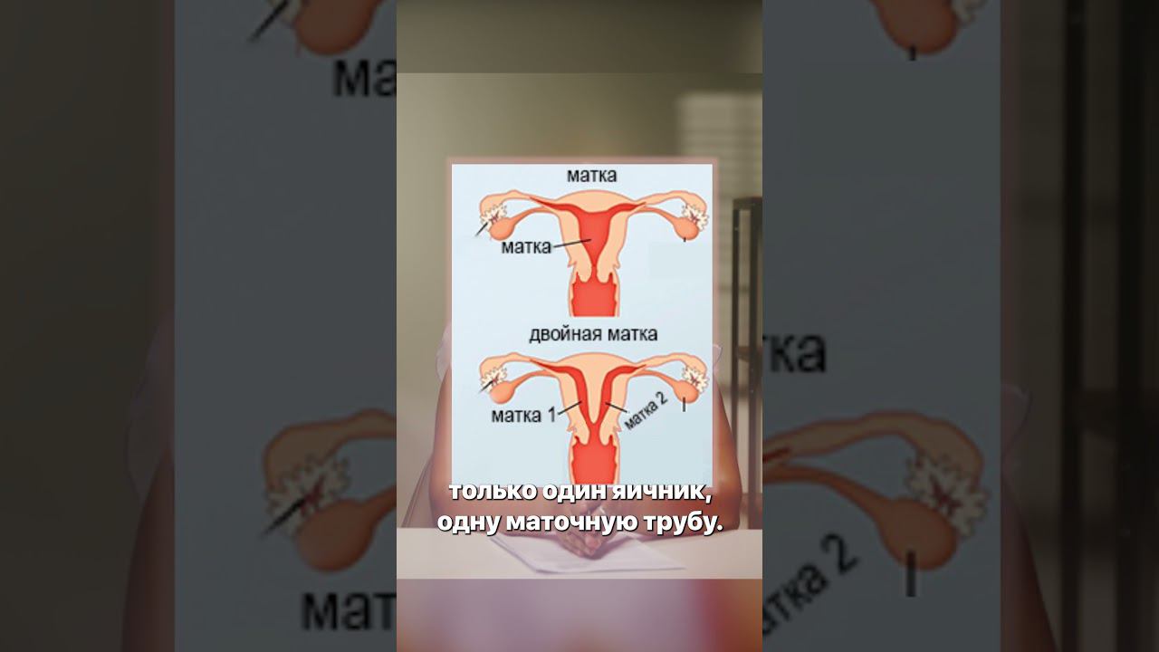 ДВОЙНАЯ МАТКА.Как это возможно? #длямамы #мамочка #супермама #мама #материнство #шокновость #shorts