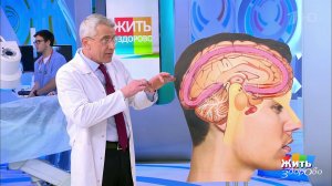 Мифы и правда о головной боли. Жить здорово! Фрагмент выпуска от 20.08.2021