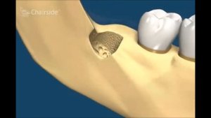 Удаление зубов  Все виды удаления зубов моляры премоляры резцы анастезии  Хирургическая стоматологи