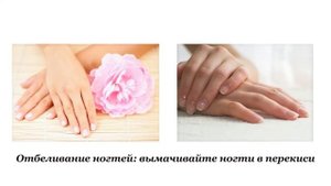 25 способов использования ПЕРЕКИСИ ВОДОРОДА, о которых ВЫ должны ЗНАТЬ!