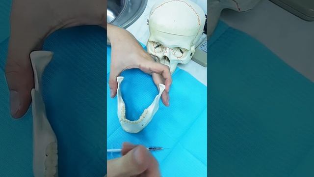 А как другие делают анестезию в стоматологии?