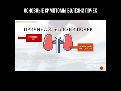 Основные симптомы болезни почек
