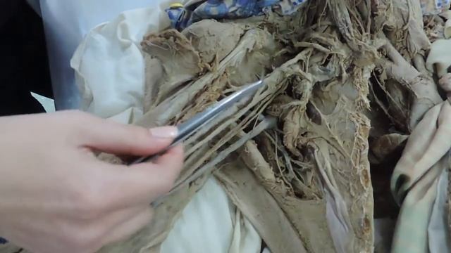 Анатомия. Длинные ветви плечевого сплетения. смотреть онлайн