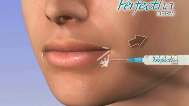Контурная пластика в Казани.Доктор Борменталь смотреть онлайн