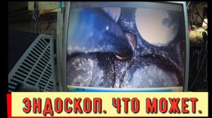 ✅ Что может эндоскоп.
