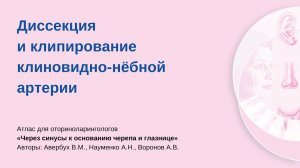 Диссекция и клипирование клиновидно-нёбной артерии. Процедуру проводит Аркадий Николаевич Науменко.