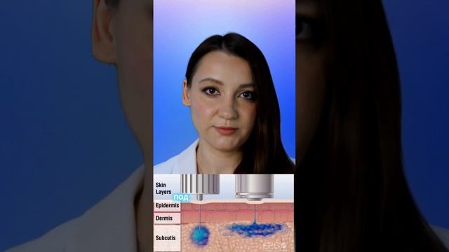 Увеличение губ без инъекций. Возможно ли? #косметолог #увеличениегуб смотреть онлайн