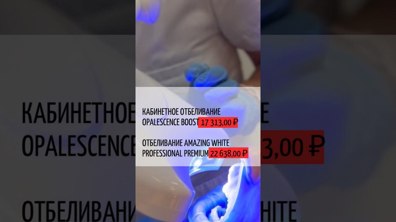 Делаете отбеливание зубов? Или считаете это ненужной процедурой? #отбеливаниезубов