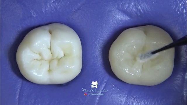 Тренировка навыков реставрации зубов.. смотреть онлайн