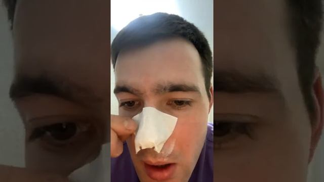 Праздники даром не проходят! Чистим лицо ! смотреть онлайн