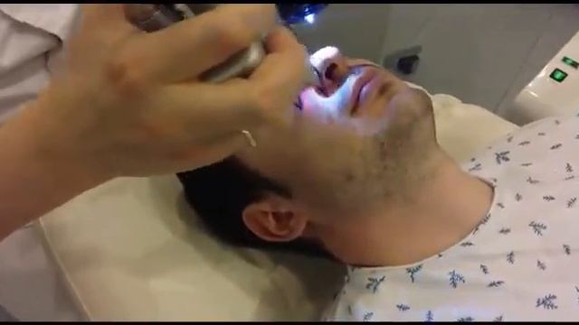Лазерная шлифовка лица на аппарате Deka CO2 в клинике Глобальный проект "Красота" смотреть онлайн